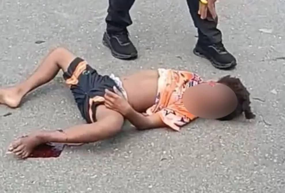 Ilustrasi berita Mimika: Laka Lantas di Jalan Poros SP 5 Timika, Seorang Anak Tidak Sadarkan Diri Usai Motor Bertabrakan dengan Mobil