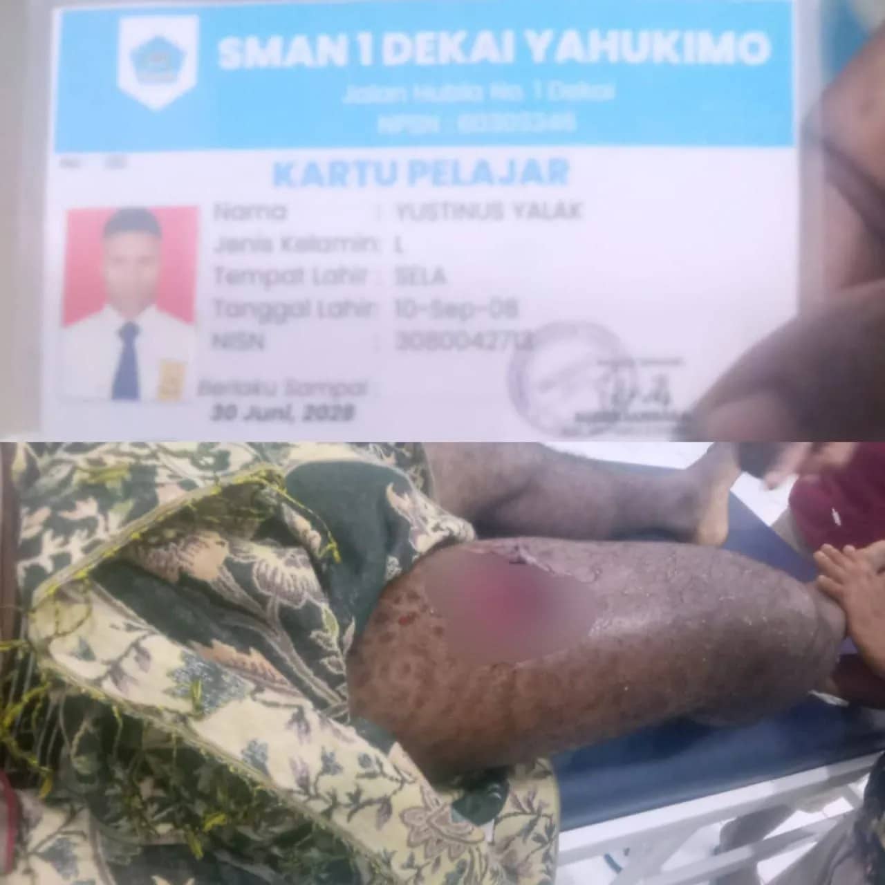 Ilustrasi berita Papua: TPNPB OPM Klaim Pelajar SMA Negeri 1 Dekai Jadi Korban Penembakan Saat Operasi Aparat di Yahukimo