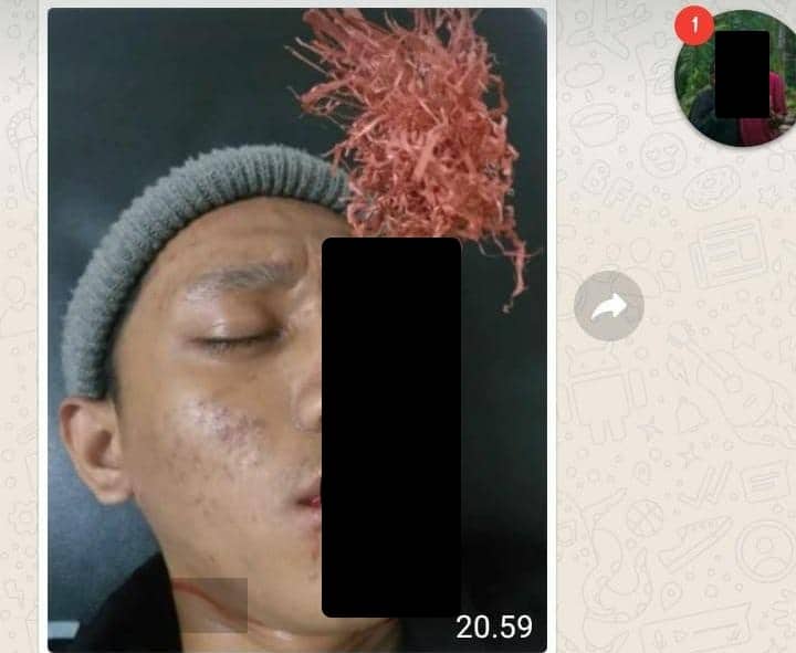 Ilustrasi berita Mimika: Tadi Malam, Ramai Beredar Foto di Timika Seorang Pria Tertancap Panah Wayer di Mata, Ini Kejadian Sesungguhnya