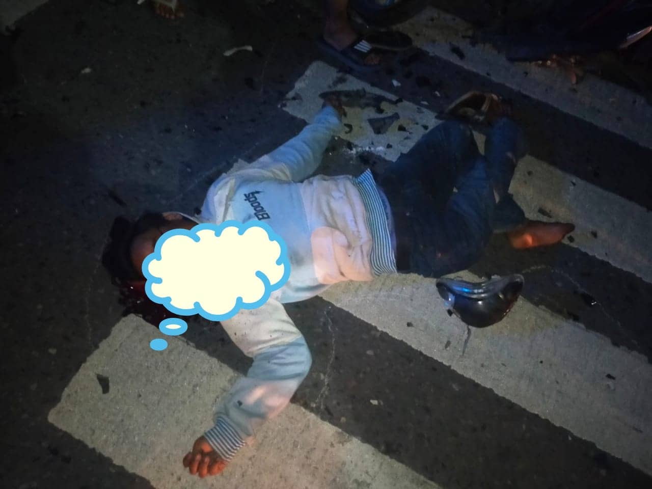 Ilustrasi berita Mimika: 3 Pengedara Motor Terlibat Kecelakaan Hebat, Dua Kaki Patah Gara-gara Kebut Lawan Arah Budi Utomo, 1 Orang Tanpa Identitas di RSUD
