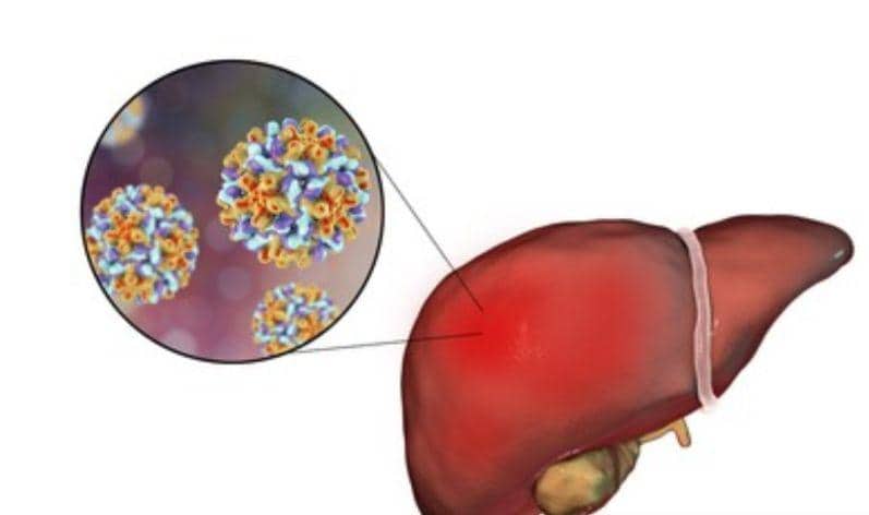 Ilustrasi berita Nasional: Kemenkes Siapkan Faskes Layani Pasien Dengan Hepatitis Akut