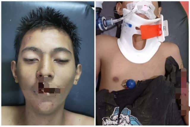 Ilustrasi berita Mimika: Flashnews, Seorang Pemuda Tewas Usai Kecelakaan di Jalan Budi Utomo Ujung, Mungkin Ada yang Kenal?