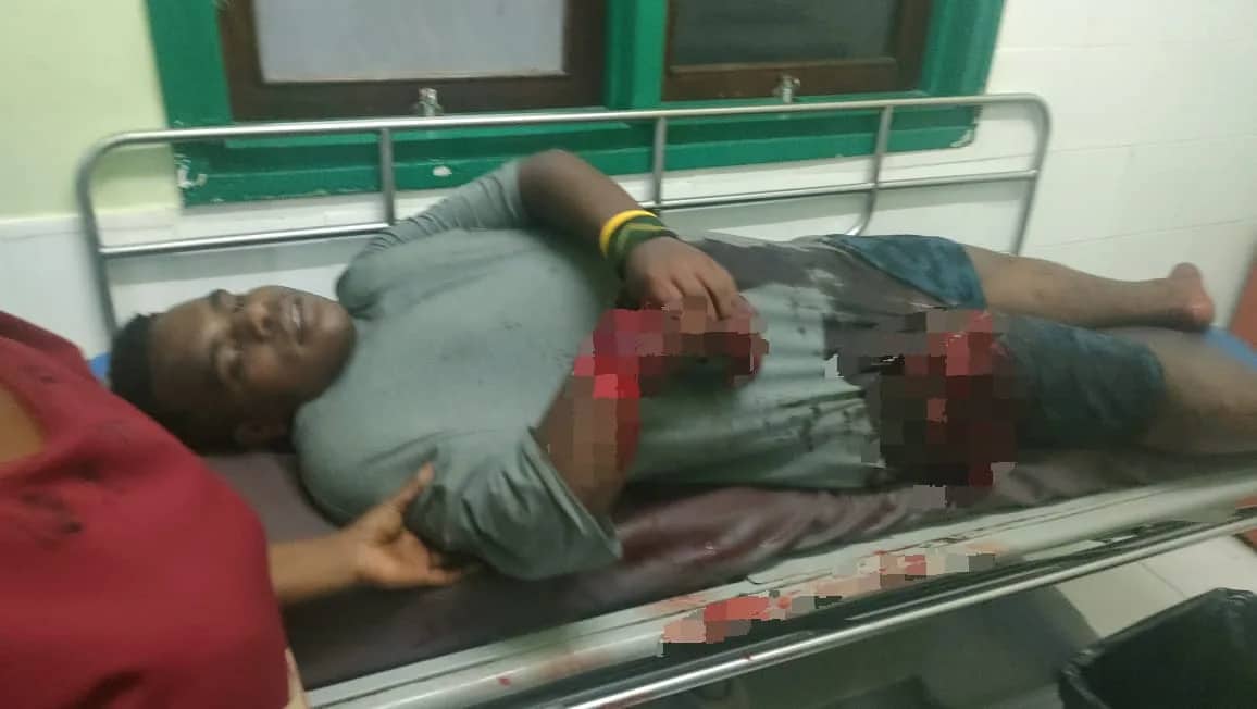 Ilustrasi berita Mimika: Seorang Pelajar Dibacok Orang Tak Dikenal, Tangan Luka Parah, Kasat Reskrim Polres Mimika : Tidak Ada Kaitan dengan Pemilu
