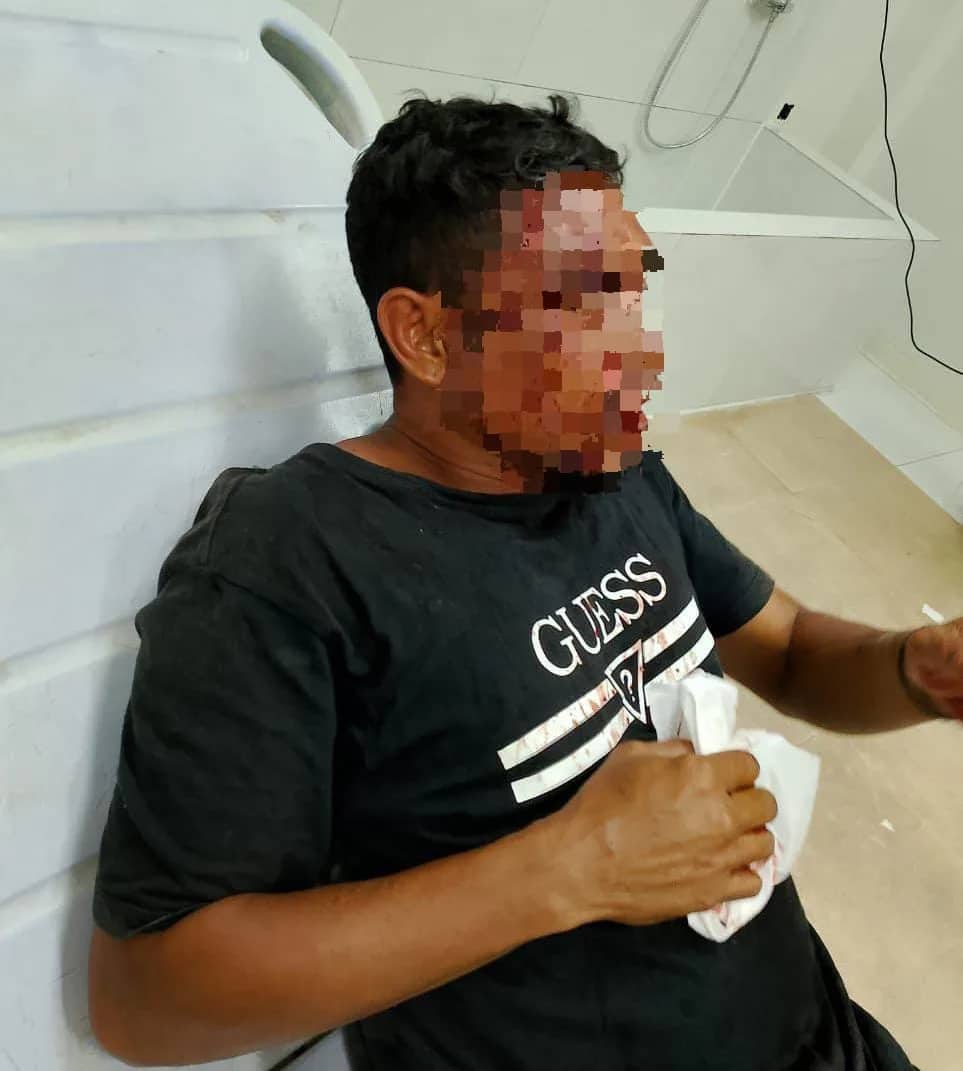 Ilustrasi berita Mimika: Niat Samperin Teman, Dua Pemuda Ini Dikeroyok di Jalan Yos Sudarso Timika