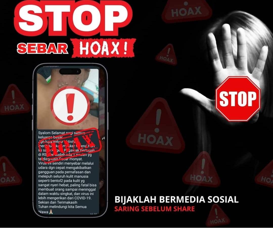 Ilustrasi berita Papua: Viral Penderita Virus Cacar Monyet Dirawat di RSUD Abepura, Kapolsek : Itu Hoax