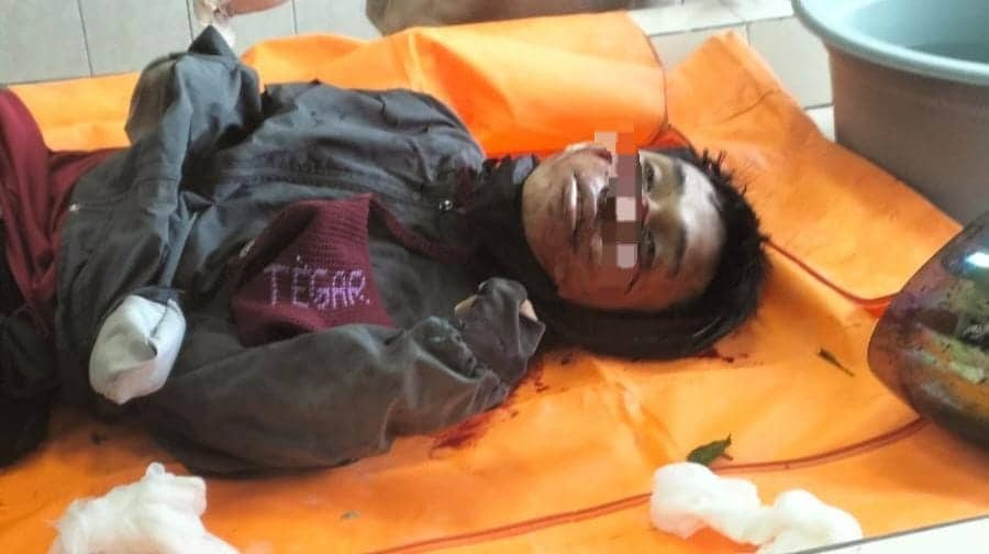 Ilustrasi berita Mimika: Kisah Pilu Cleaning Service RSUD Mimika, Temukan Jenazah Anaknya Sendiri di Kamar Mayat