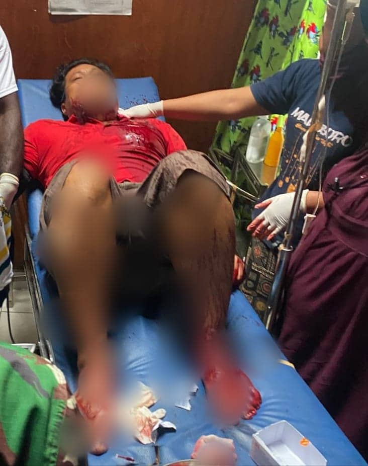 Ilustrasi berita Papua: Lagi Korban Penembakan, Seorang Pria Dilaporkan Ditembak OTK di Kabupaten Puncak Jaya