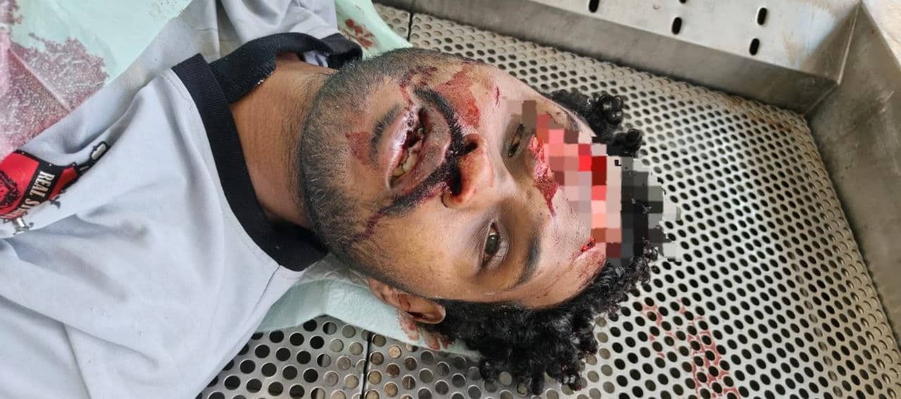Ilustrasi berita Mimika: Mr X Korban Laka Tunggal Ditemukan di Jalan Ahmad Yani, Jenazah Disemayamkan di RSUD Mimika