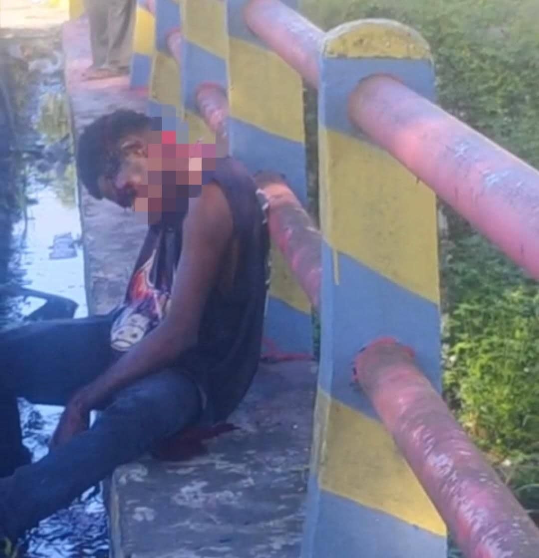 Ilustrasi berita Mimika: Pria Ditemukan Tergeletak dengan Luka di Leher di Jembatan Kilo 9 Timika, Diduga Akibat Kecelakaan