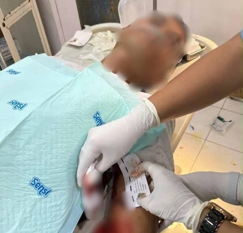 Warga yang menjadi korban penikaman mendapatkan perawatan medis di RSUD Dekai. Di lokasi berbeda, sebuah warung kopi milik warga dibakar di Distrik Dekai, Yahukimo.