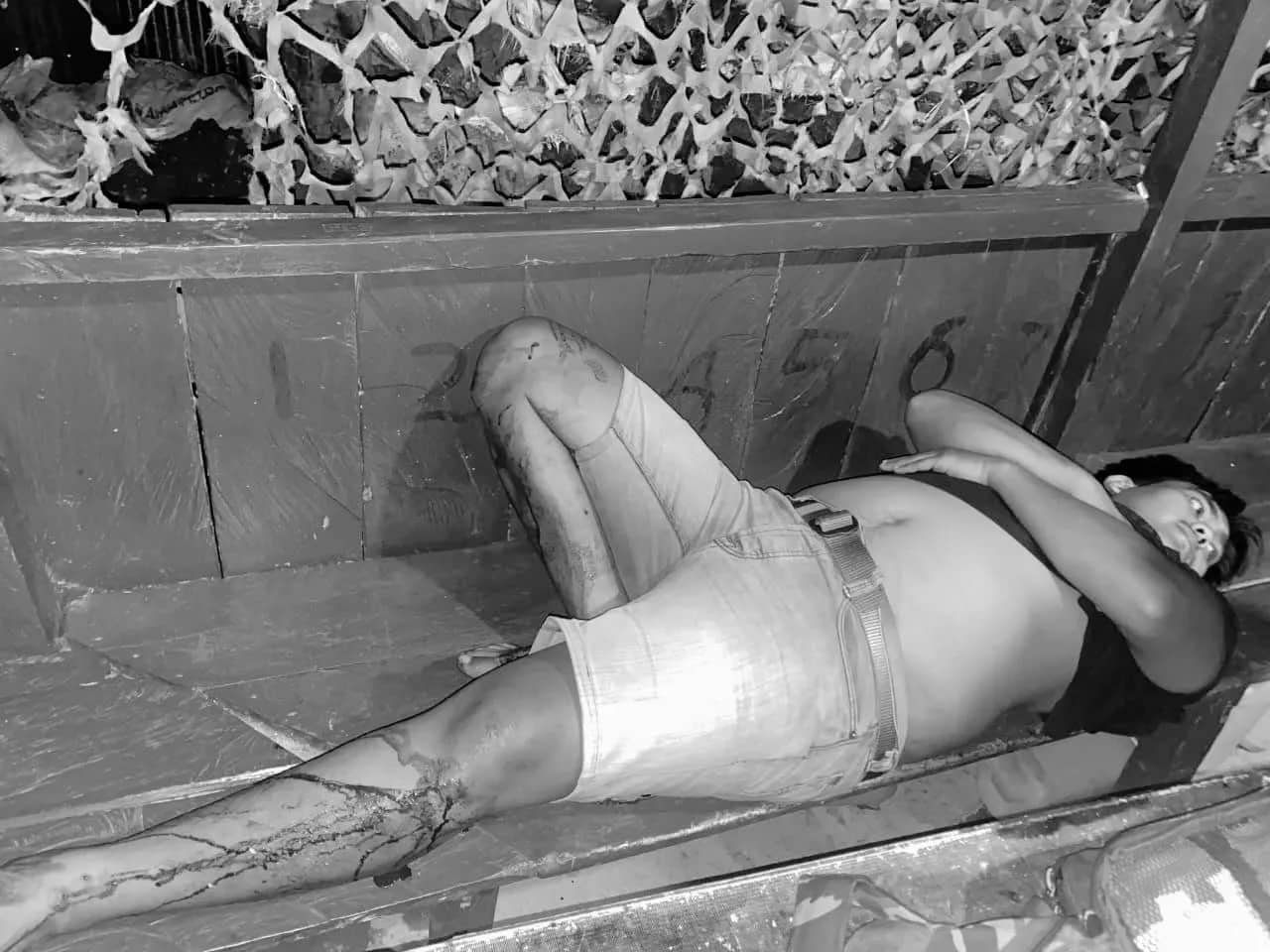 Korban penembakan oleh kelompok OPM