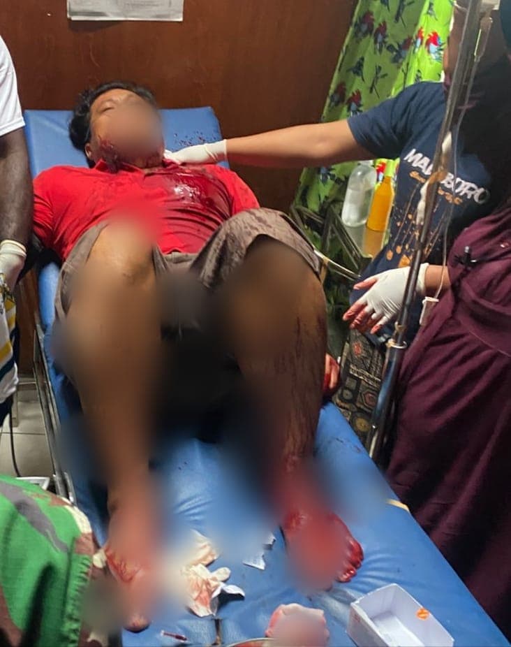 Ilustrasi berita PAPUA: Lagi Korban Penembakan, Seorang Pria Dilaporkan Ditembak OTK di Kabupaten Puncak Jaya