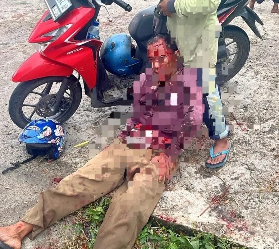 Ilustrasi berita Papua Tengah: Tukang Ojek Dibacok di Bagian Kepala oleh Dua Orang Tak Dikenal di Nabire