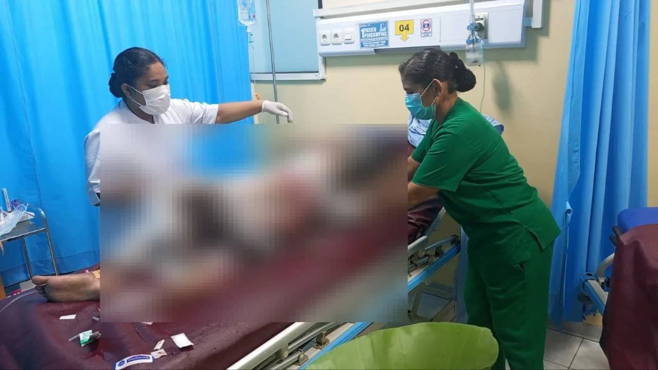 Korban yang dibakar ibu kandungnya hingga meninggal dunia di Sentani Timur, Kabupaten Jayapura.