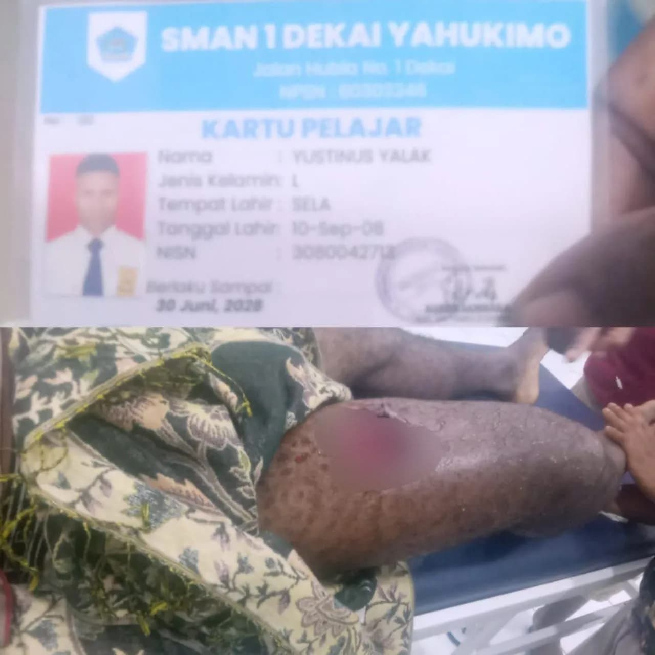 Ilustrasi berita Papua: TPNPB OPM Klaim Pelajar SMA Negeri 1 Dekai Jadi Korban Penembakan Saat Operasi Aparat di Yahukimo