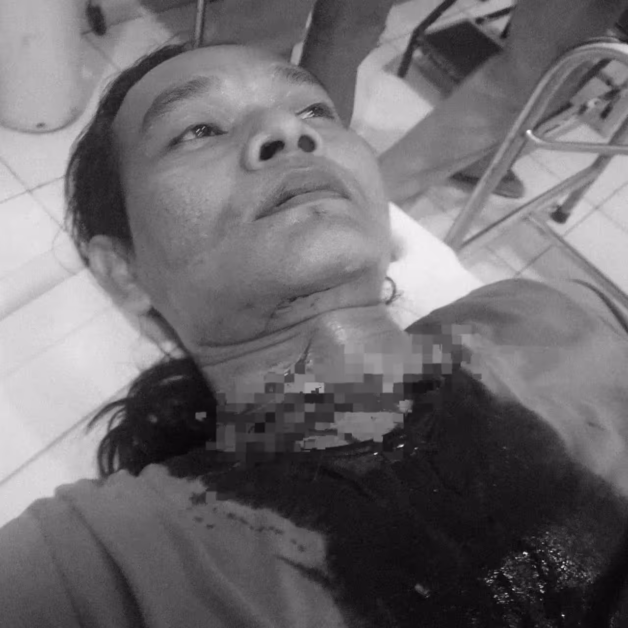 Tampak korban mengalami luka bacok di leher.