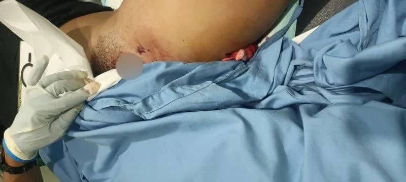 Korban penembakan TPNPB.