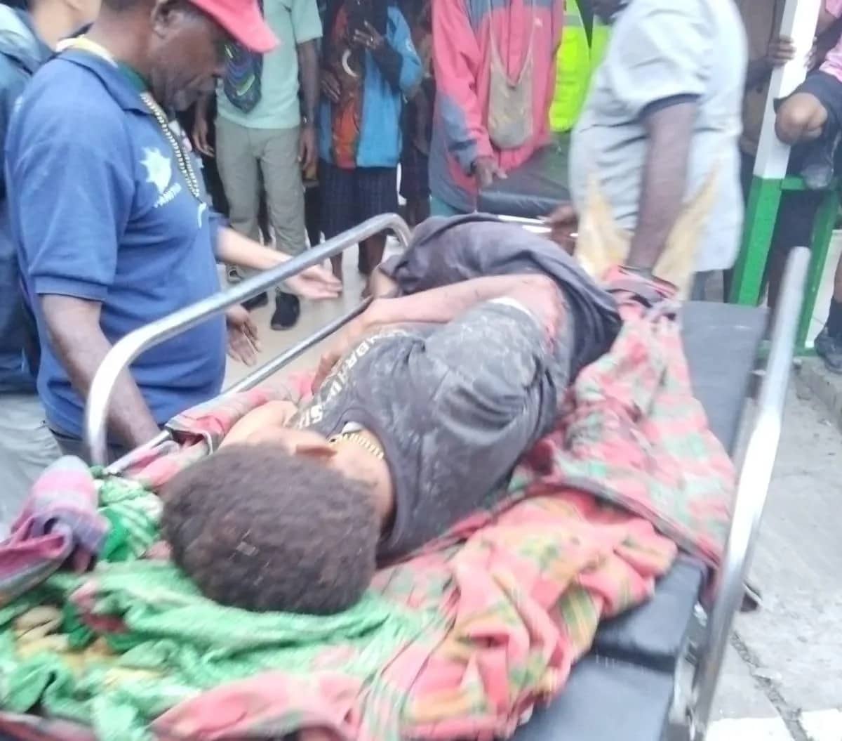 Para korban yang mengalami luka akibat ledakan granat di Kampung Danggoa, Kabupaten Intan Jaya, Kamis (18/6/2026).