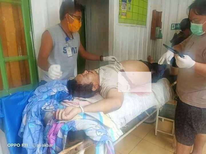 Oktavianus Rayo yang ditembak KKB