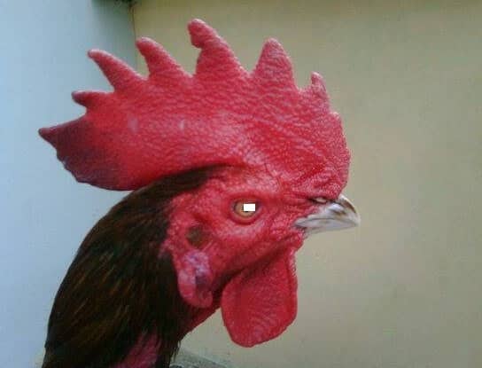 Ilustrasi berita Kesehatan: Sunat model baru "Jengger Ayam", Jadi pilihan untuk kepuasan seksual
