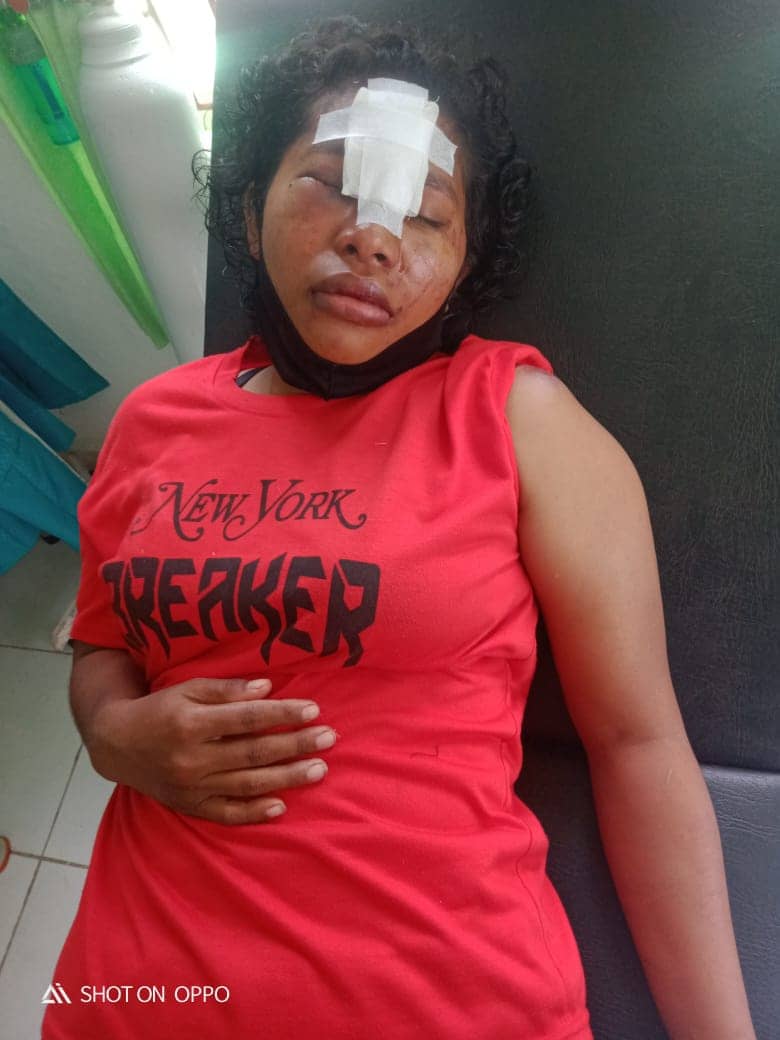Guru SD YPPK Muare yang dirampok seorang pria