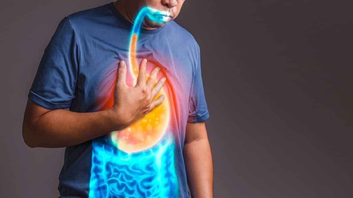Ilustrasi berita LIFESTYLE: Solusi Sederhana Cegah Asam Lambung Naik tanpa Obat
