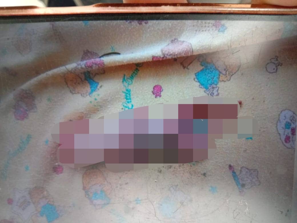 Orok bayi yang ditemukan di gang Semangka SP 2