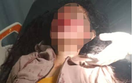 Korban terbaring di RSUD Mimika.