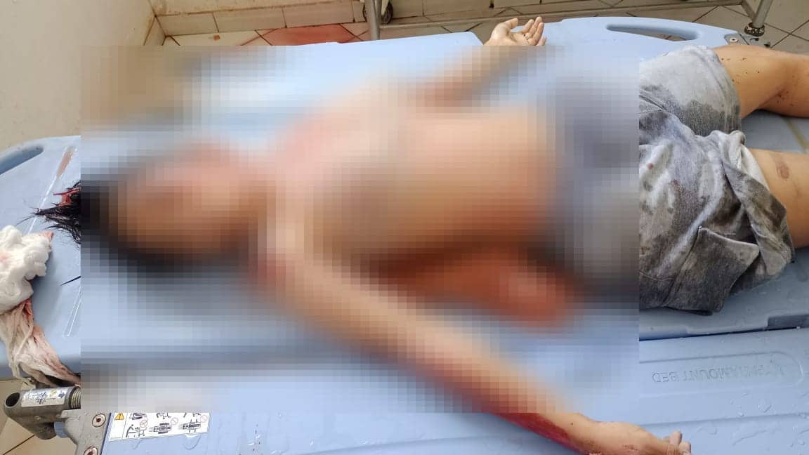 Ilustrasi berita JAYAPURA: Hilang Kendali, Pengendara Sepeda Motor Tewas Dilindas Truk di Sentani