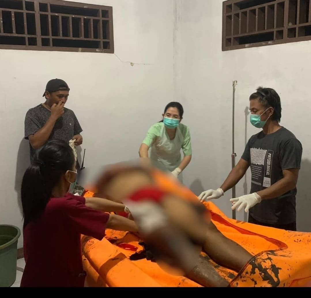 Ilustrasi berita Papua: La Jahari yang Tewas di Yahukimo Alami Luka Parah Diwajah