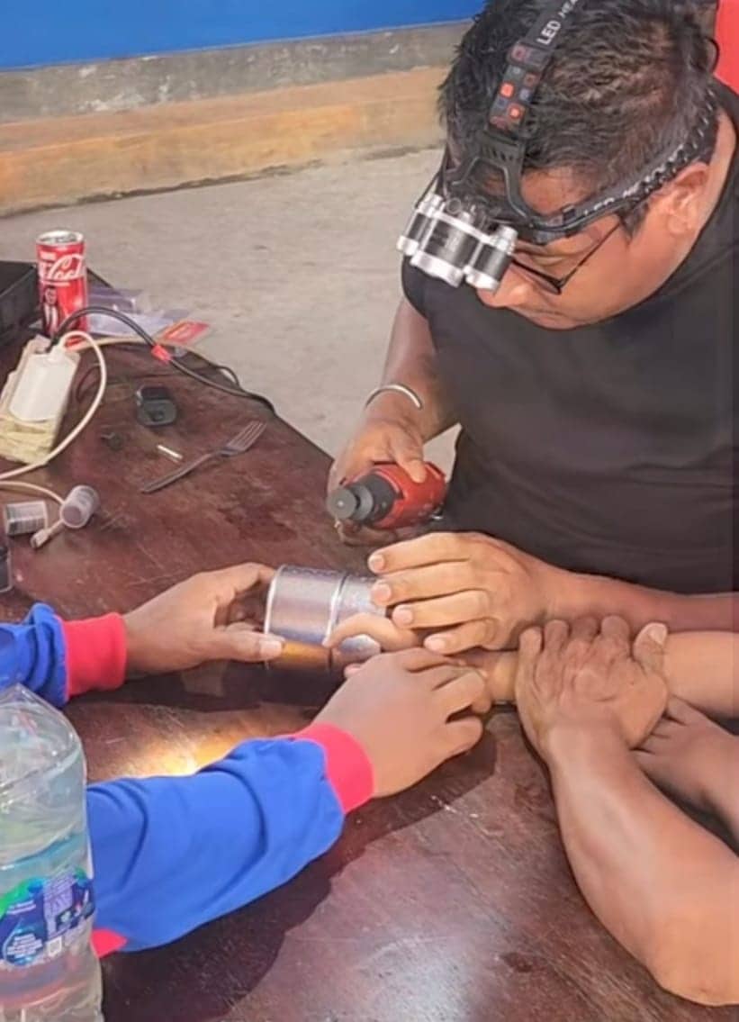 Ilustrasi berita Mimika: Viral di Media Sosial! Petugas Damkar Mimika Bantu Evakuasi Jari Anak dari Rumah Sumbu Kompor Minyak