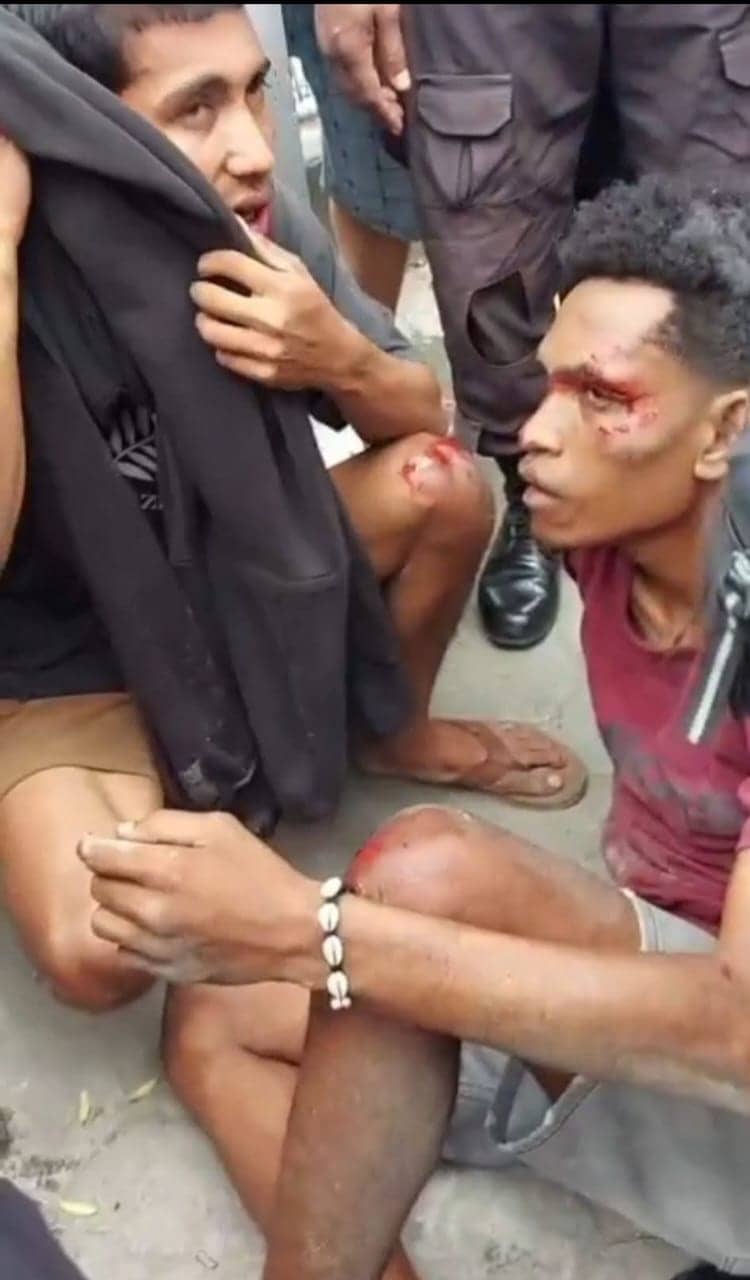 Ilustrasi berita JAYAPURA: Aksi Penjambretan Gagal, Dua Pelaku Terlibat Kecelakaan Saat Melarikan Diri