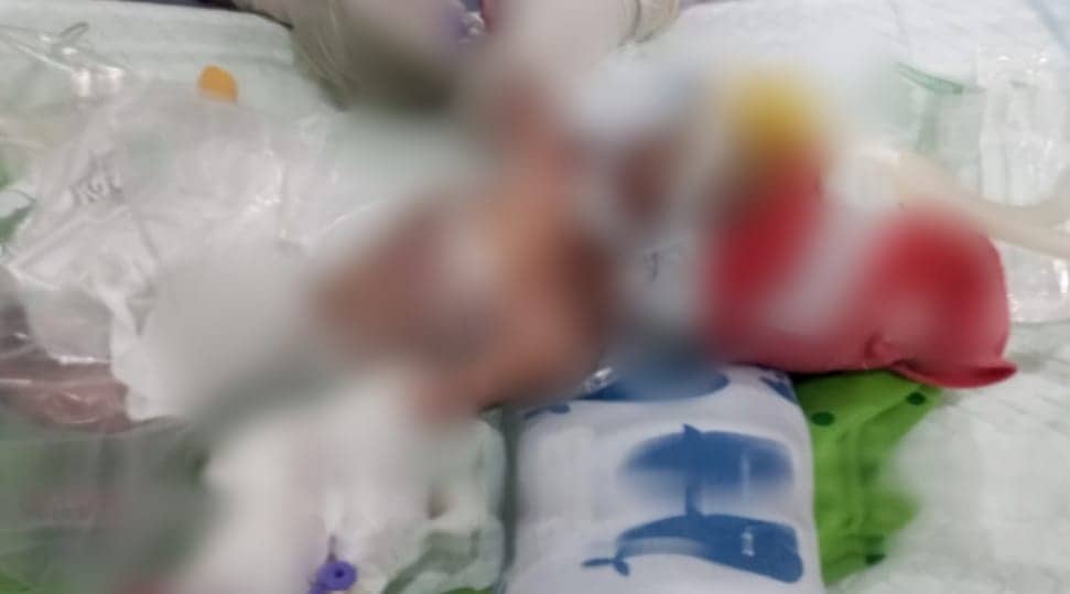 Ilustrasi berita Mimika: Tragis, Bayi Perempuan yang Ditemukan di Tempat Sampah RSUD Mimika Meninggal Dunia
