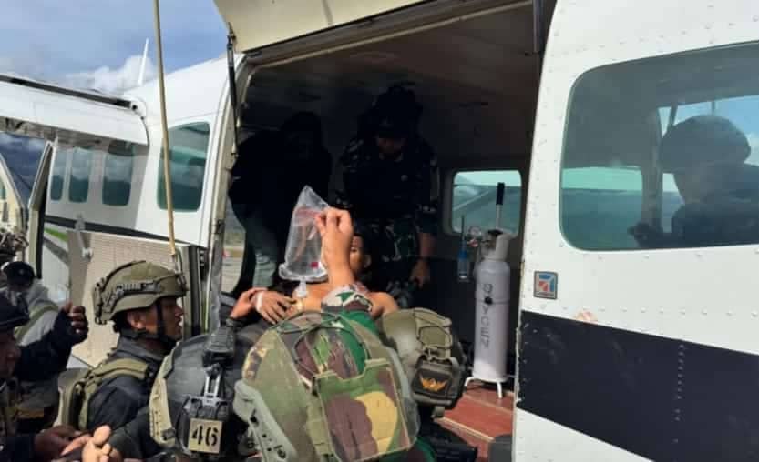 Opm tni