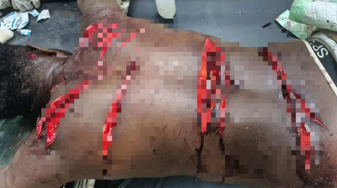 Ilustrasi berita BERITA UTAMA: Dipicu Keributan di Tempat Acara, Seorang Pria di Merauke Alami Luka Bacok di Bagian Belakang Tubuh