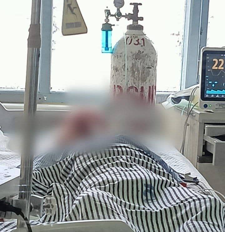 Ilustrasi berita Mimika: Penganiayaan Gunakan Palu di Kuala Kencana, Siswa Magang Meninggal Dunia