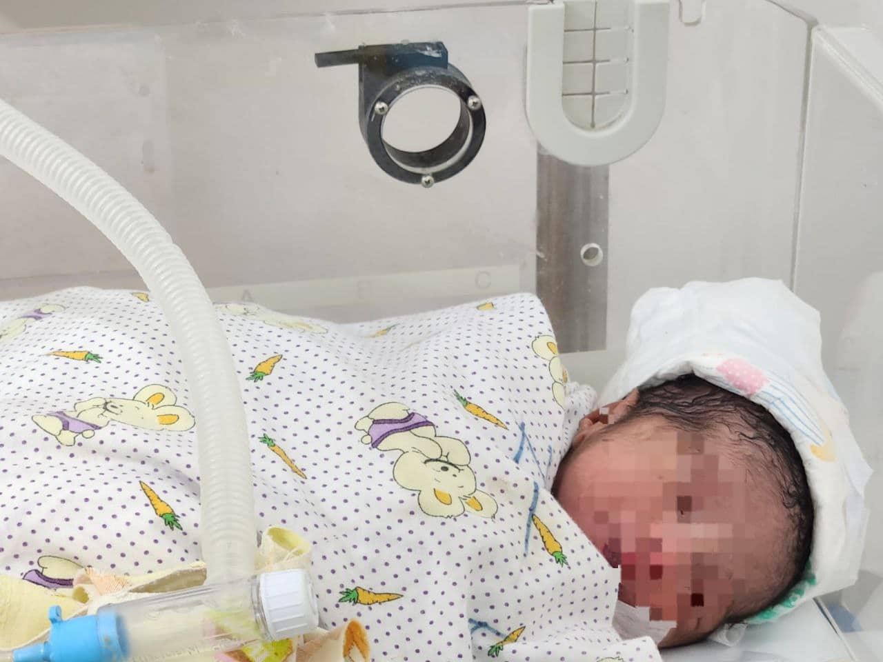 Ilustrasi berita Kesehatan: Masih Tersambung Ari-ari, Bayi Perempuan Ditemukan Dalam Karung Beras di BTN Moria Sentani