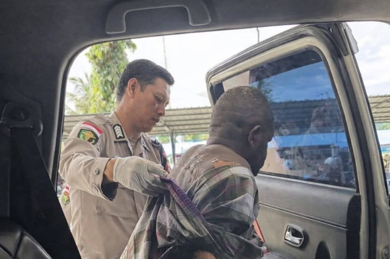 Ilustrasi berita Opini: Seorang Wanita Bakar Pacarnya di Kamar Hotel Abepura, Korban Alami Luka Bakar 50 Persen