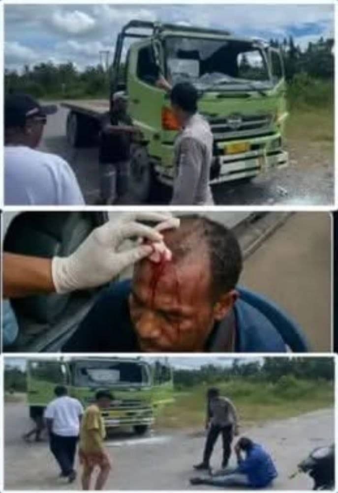Ilustrasi berita Mimika: Diduga Mabuk, 20 Pelajar SMK di Distrik Mimika Timur Keroyok Sopir Kontainer, Korban Alami Luka Robek di Kepala